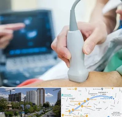 اکو قلب شبانه روزی در اندرزگو 