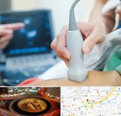 اکو قلب شبانه روزی در میدان ولیعصر 