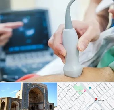 اکو قلب شبانه روزی در مصلی مشهد