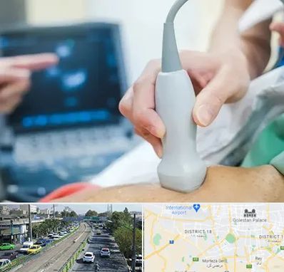 اکو قلب شبانه روزی در جنوب تهران 