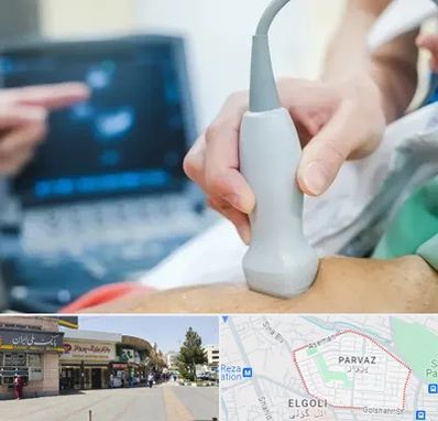 اکو قلب شبانه روزی در پرواز تبریز