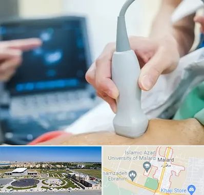 اکو قلب شبانه روزی در ملارد