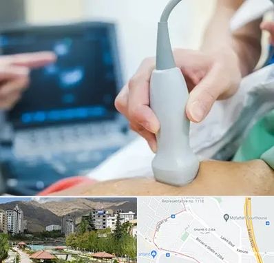 اکو قلب شبانه روزی در شهر زیبا 