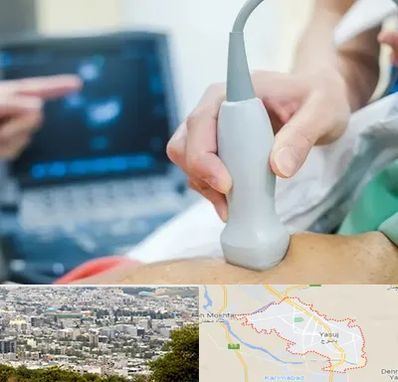 اکو قلب شبانه روزی در یاسوج