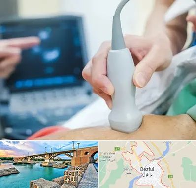 اکو قلب شبانه روزی در دزفول