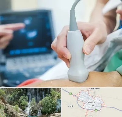 اکو قلب شبانه روزی در شیروان