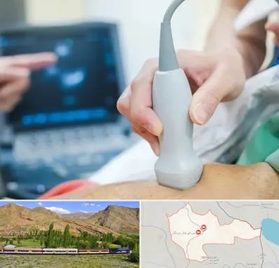 اکو قلب شبانه روزی در خاش