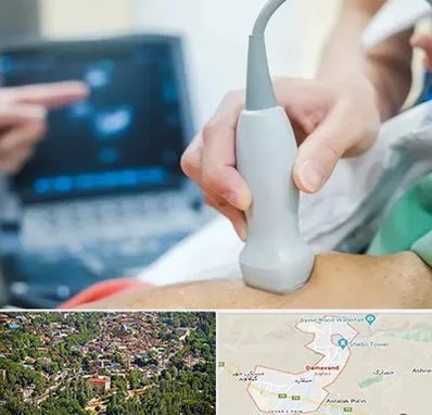 اکو قلب شبانه روزی در دماوند