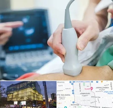 اکو قلب شبانه روزی در جمهوری 