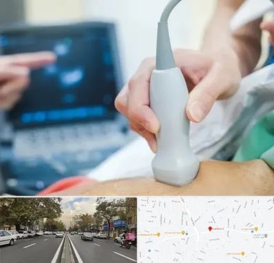 اکو قلب شبانه روزی در دولت 