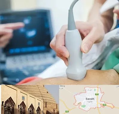 اکو قلب شبانه روزی در ساوه