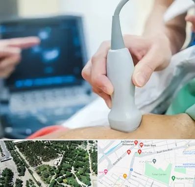 اکو قلب شبانه روزی در سالاریه قم