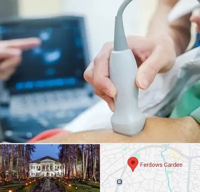 اکو قلب شبانه روزی در باغ فردوس