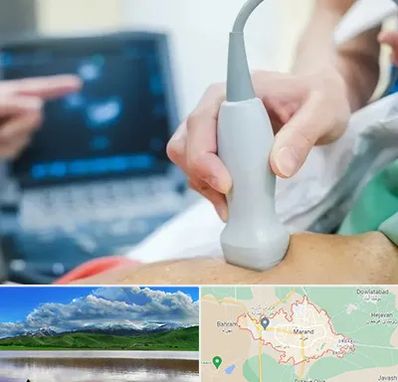 اکو قلب شبانه روزی در مرند