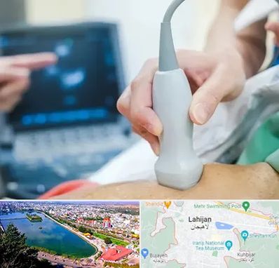 اکو قلب شبانه روزی در لاهیجان