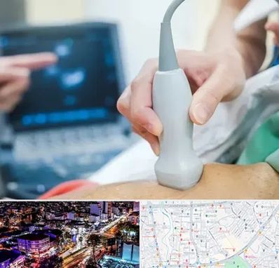 اکو قلب شبانه روزی در منظریه رشت 