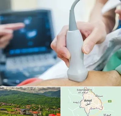 اکو قلب شبانه روزی در آمل