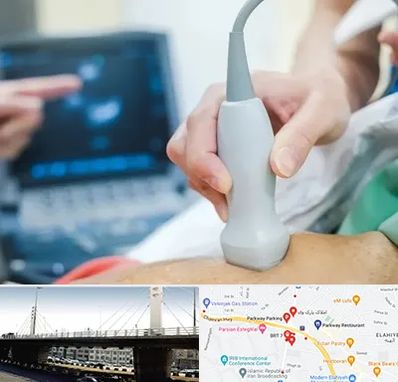 اکو قلب شبانه روزی در پارک وی 