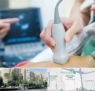 اکو قلب شبانه روزی در آپادانا