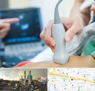 اکو قلب شبانه روزی در رسالت 