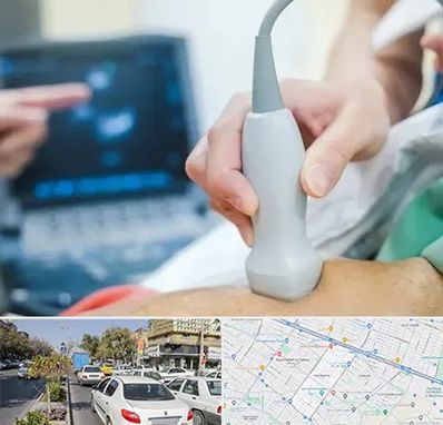 اکو قلب شبانه روزی در مفتح مشهد