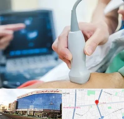 اکو قلب شبانه روزی در نصف راه تبریز