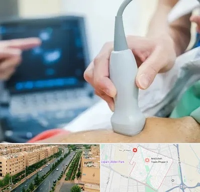 اکو قلب شبانه روزی در فاز سه اندیشه
