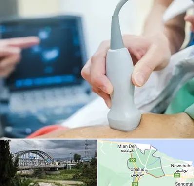 اکو قلب شبانه روزی در چالوس