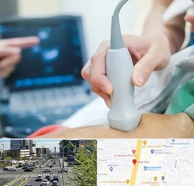 اکو قلب شبانه روزی در ستاری 