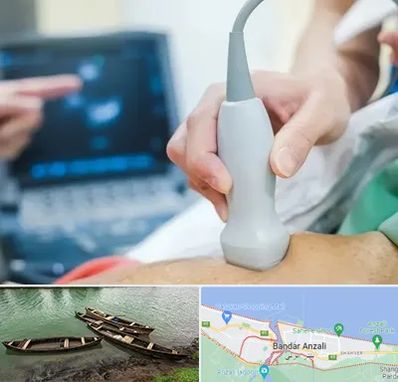 اکو قلب شبانه روزی در بندر انزلی