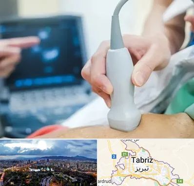 اکو قلب شبانه روزی در تبریز