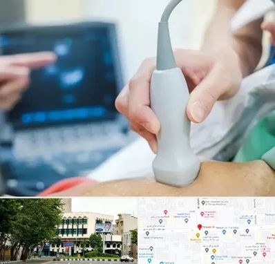 اکو قلب شبانه روزی در طالقانی 