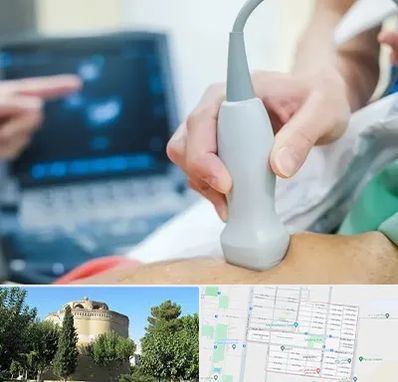 اکو قلب شبانه روزی در مرداویج اصفهان