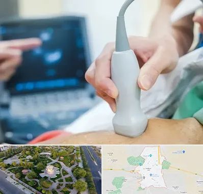 اکو قلب شبانه روزی در کاشمر