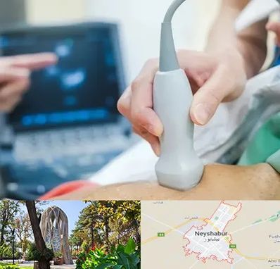 اکو قلب شبانه روزی در نیشابور