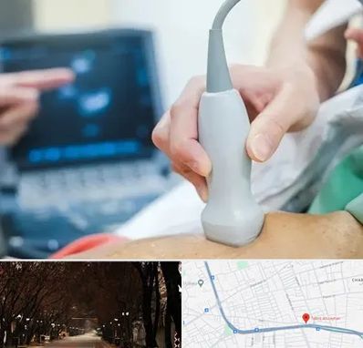 اکو قلب شبانه روزی در ابوریحان تبریز