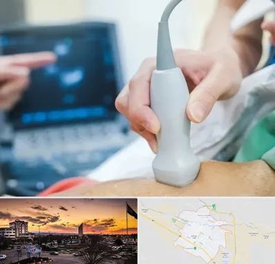 اکو قلب شبانه روزی در قوچان