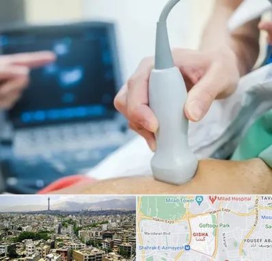 اکو قلب شبانه روزی در گیشا 