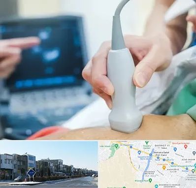 اکو قلب شبانه روزی در شریعتی مشهد