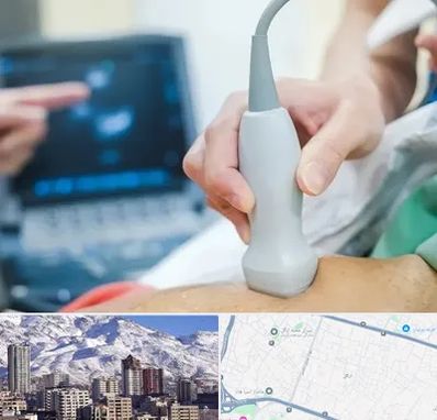 اکو قلب شبانه روزی در ازگل