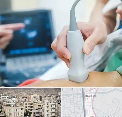 اکو قلب شبانه روزی در اسکندری