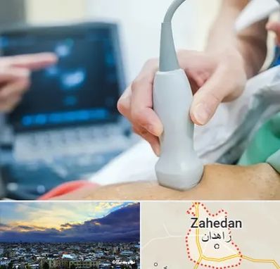 اکو قلب شبانه روزی در زاهدان