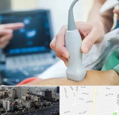 اکو قلب شبانه روزی در زرتشت