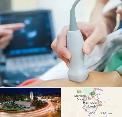 اکو قلب شبانه روزی در همدان