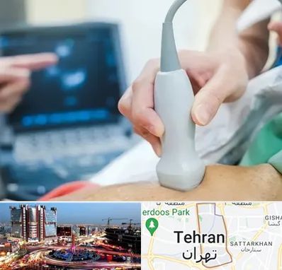 اکو قلب شبانه روزی در صادقیه 