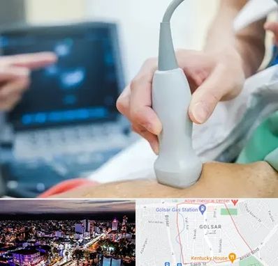 اکو قلب شبانه روزی در گلسار رشت 