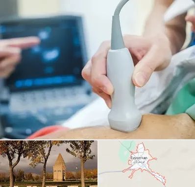 اکو قلب شبانه روزی در تویسرکان