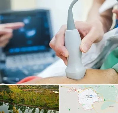 اکو قلب شبانه روزی در بهبهان