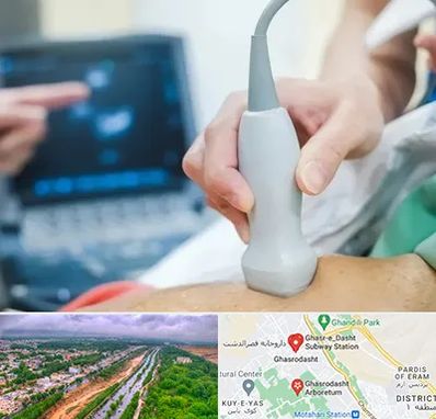 اکو قلب شبانه روزی در قصرالدشت شیراز