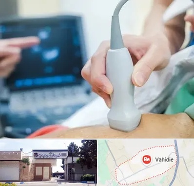 اکو قلب شبانه روزی در وحیدیه شهریار